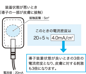 導子装着状態が良いときの3倍の電流密度となり、皮膚に対する刺激も3倍になります。